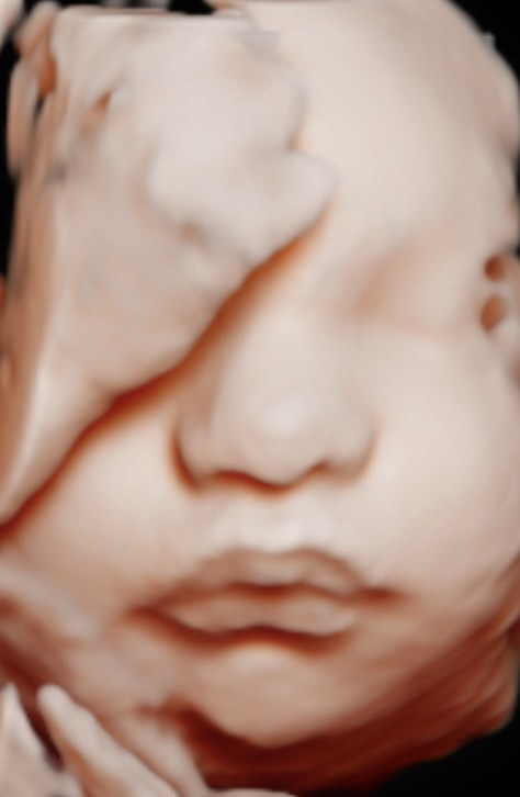 Ultrassom 4D mostrando o rosto e a mãozinha do bebê
