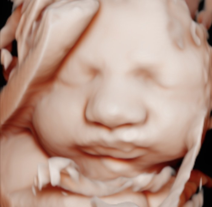 Ultrassom 4D com o bebê tocando o próprio rosto